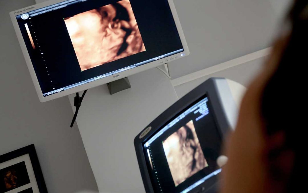 Photo of ultrasound monitor