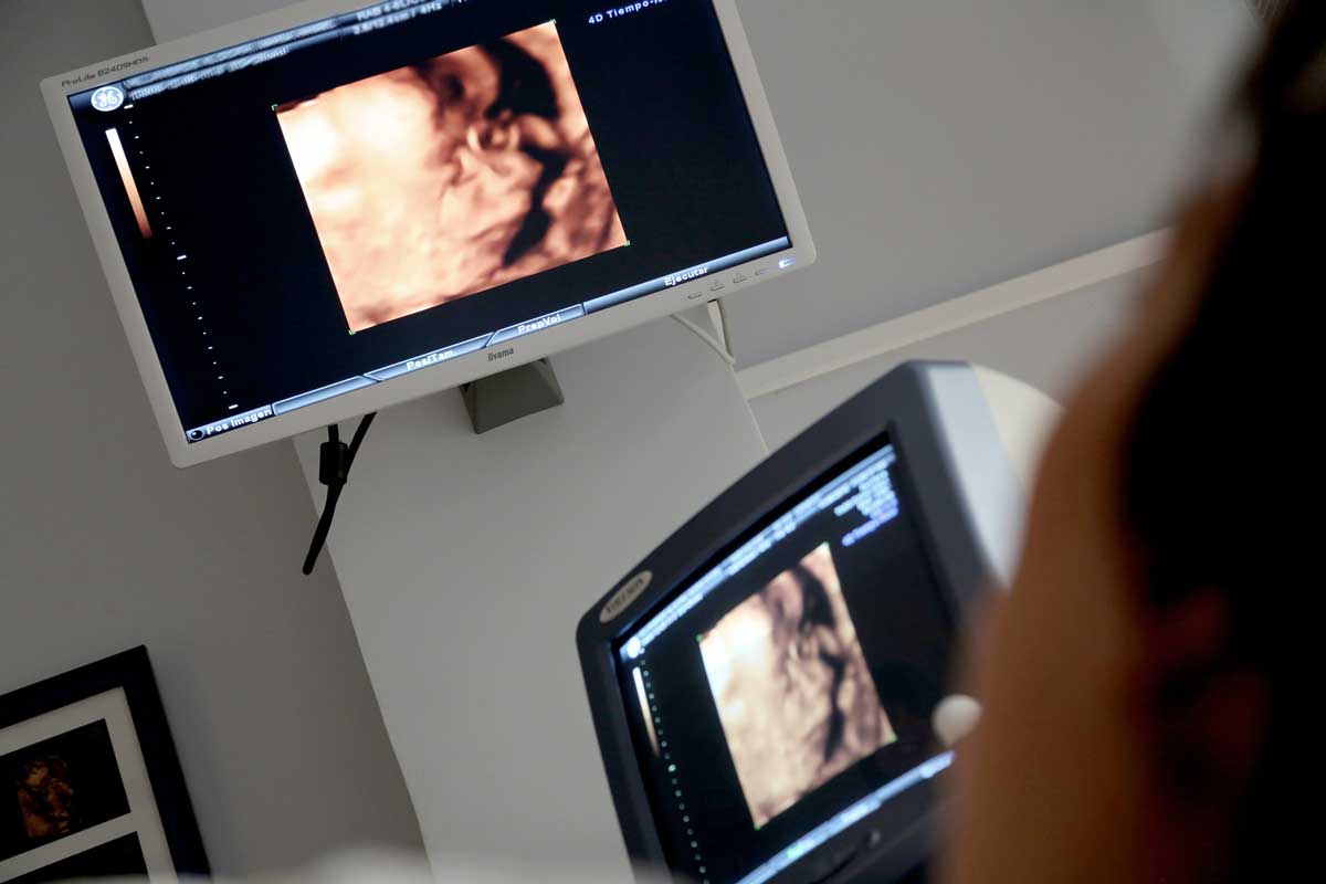 Photo of ultrasound monitor