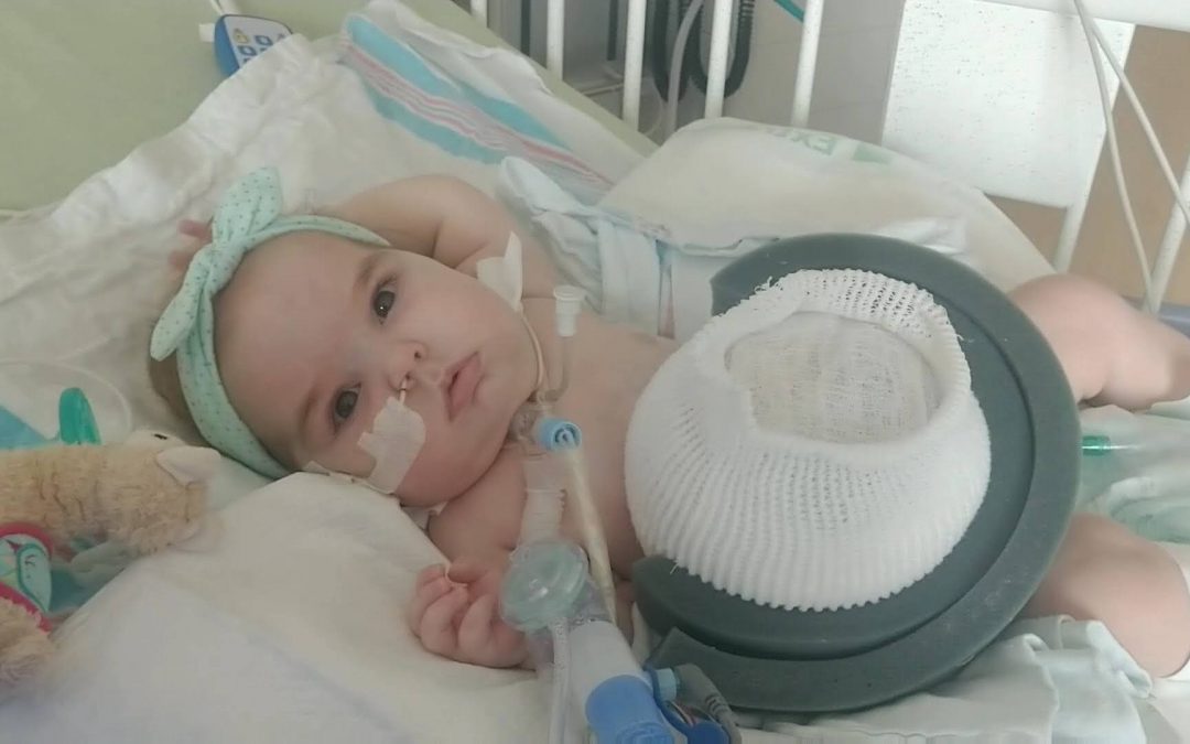 An alert infant patient with a light green bow headband being treated for a giant omphalocele looks at the camera.