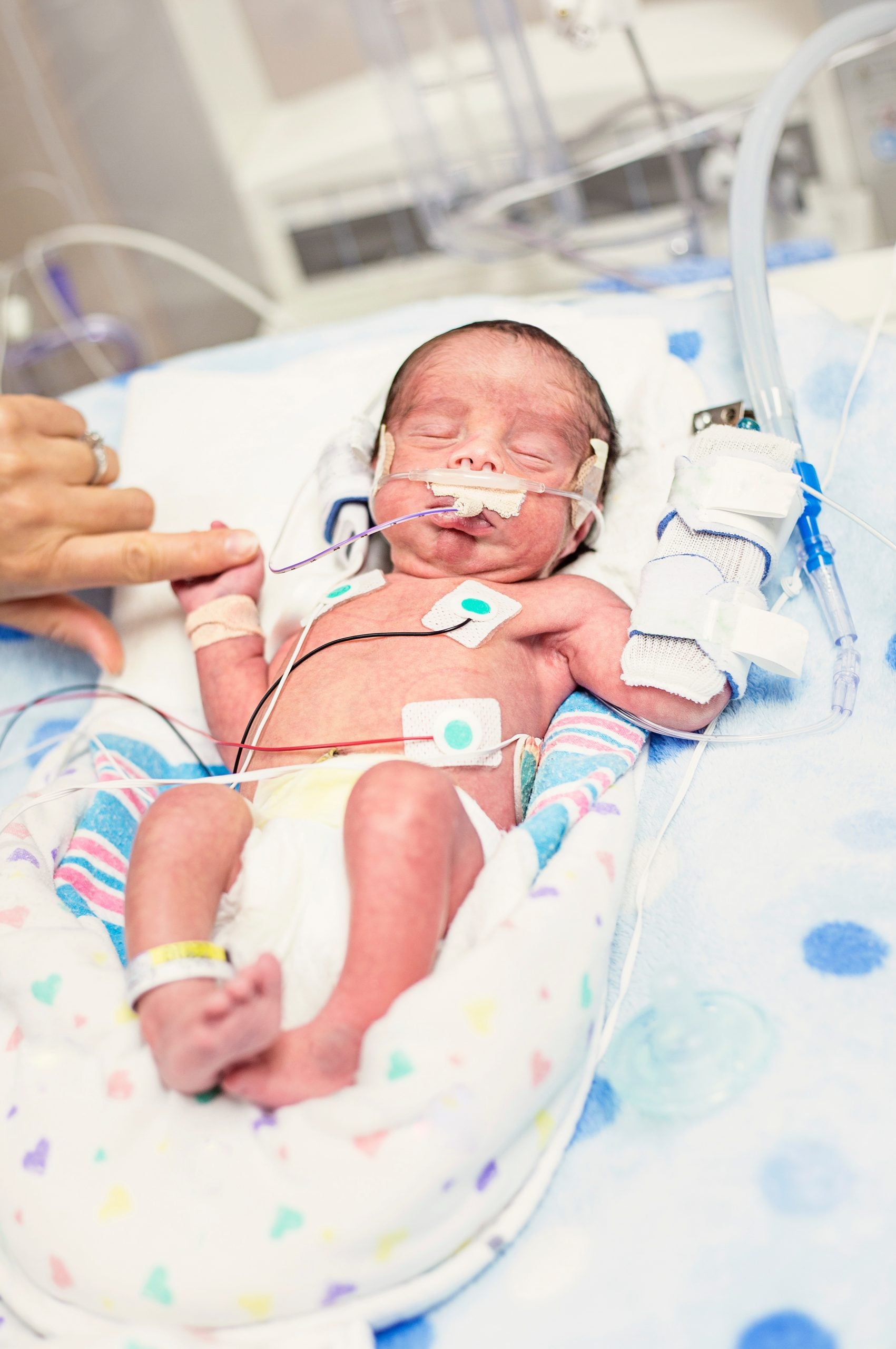 Mother touching her premature newborn baby as he is hooked up to an IV and health monitors while being treated in intensive care Premature infant lies in NICU, holding finger of caregiver