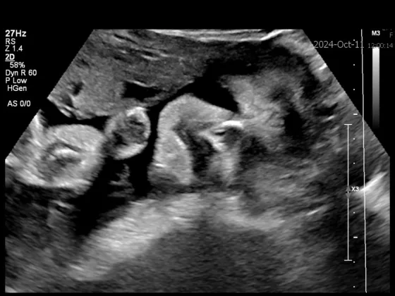 Why fetal MRI & ultrasound images can look supernatural, but their value is out of this world