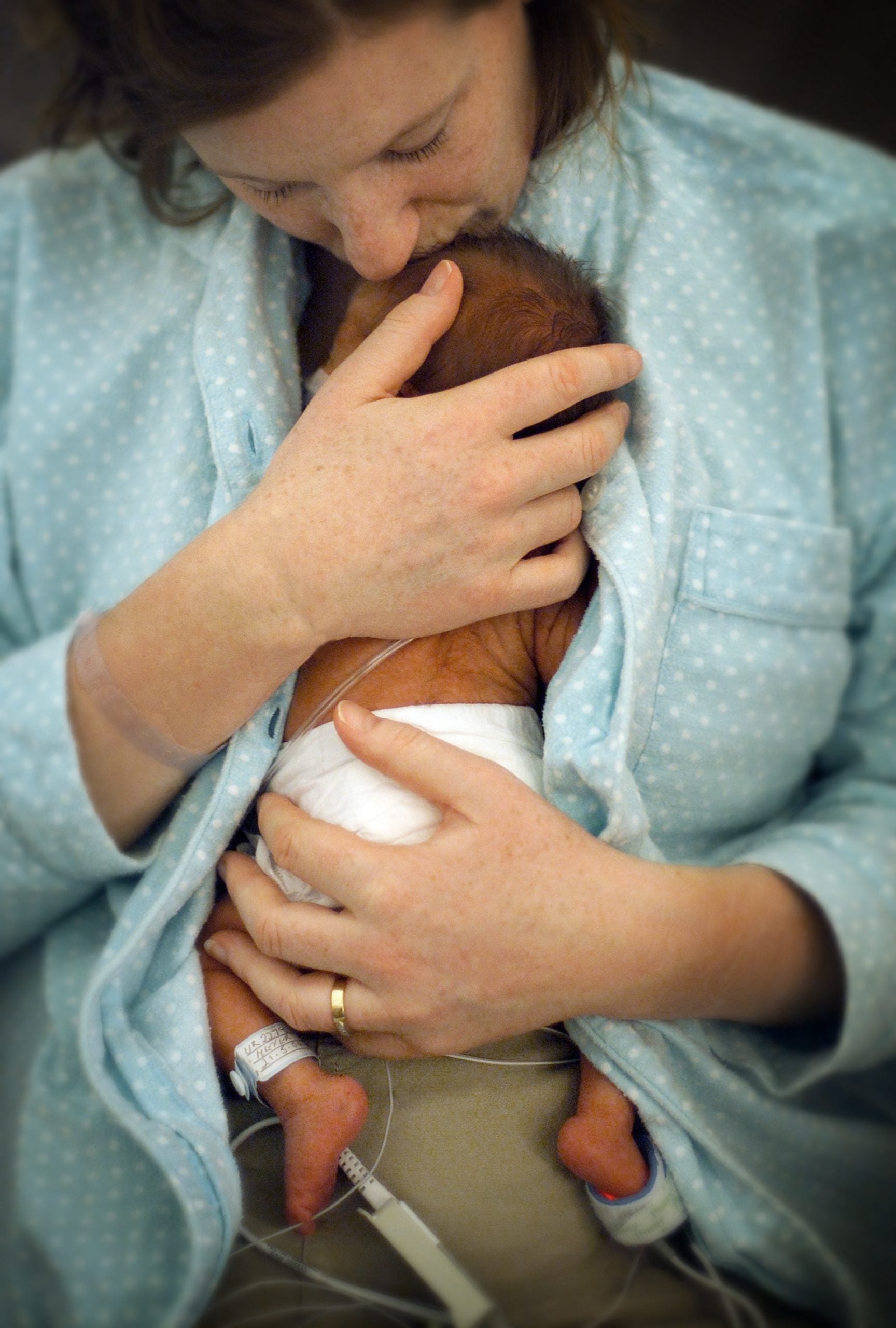 Premature Baby Mom holds premature baby against her skin and snuggles into his head.