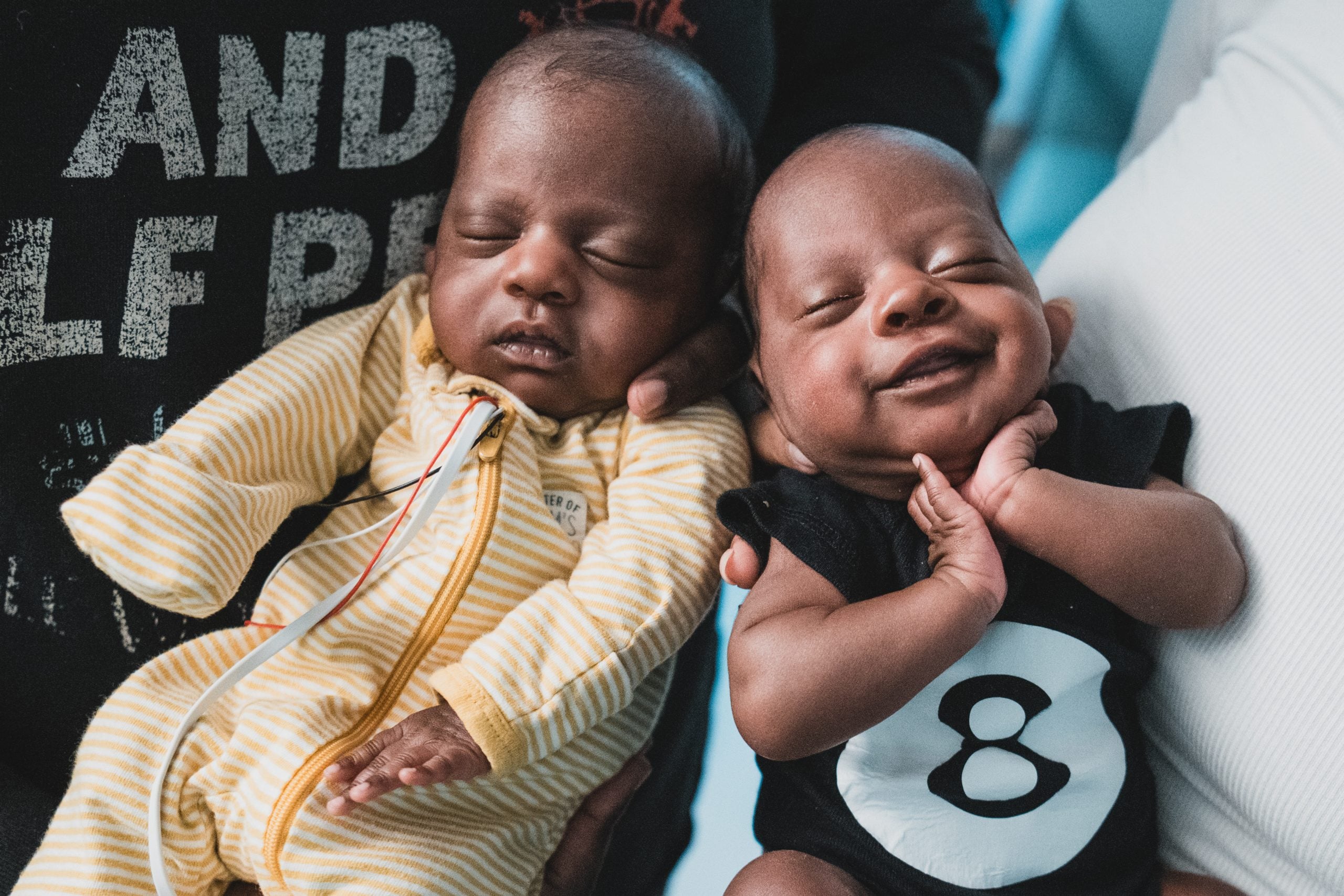 Twins nicu CT kids ttts Twins Xavier and Bryson are thriving after a TTTS diagnosis and successful treatment at Connecticut Children's.